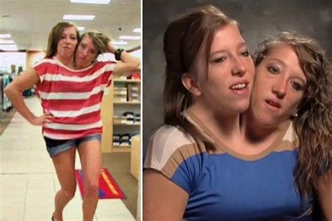 conjoined twins abby and brittany tragic news